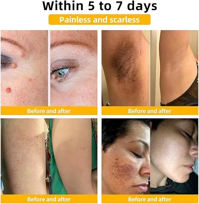 Zidella Skin Lighting Blemish Cream (50 g)