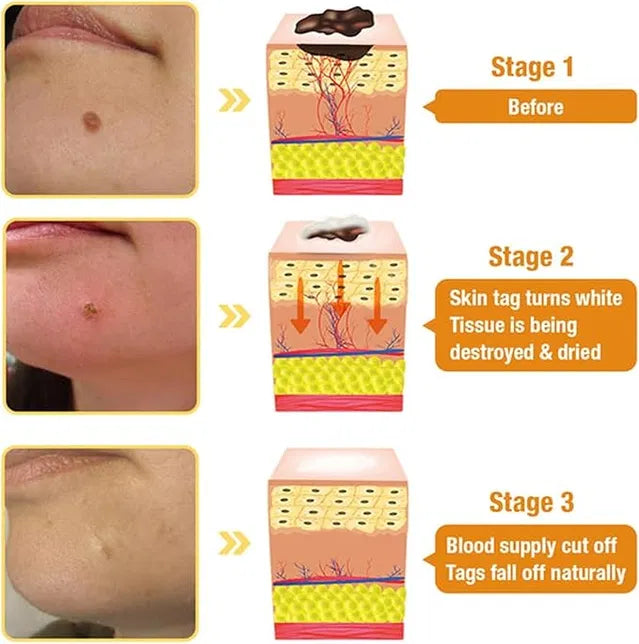 Zidella Skin Lighting Blemish Cream (50 g)